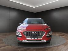 HYUNDAI Kona 1.6 CRDI Vertex 4WD DCT, Diesel, Occasioni / Usate, Automatico - 3