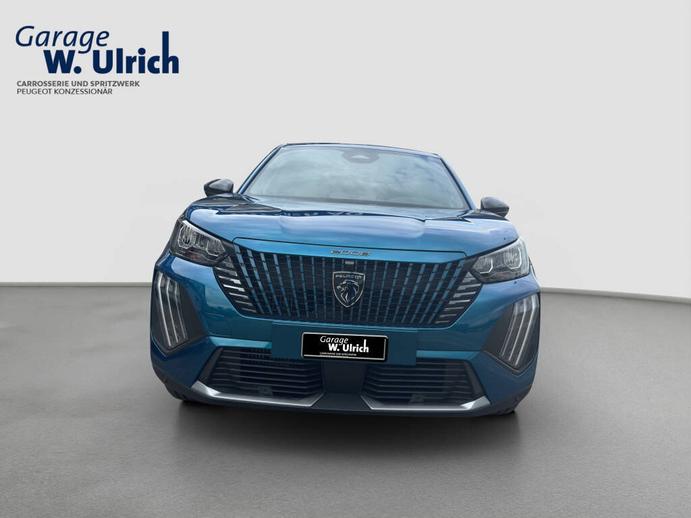 PEUGEOT 2008 1.2 Hybrid Allure, Hybride Leggero Benzina/Elettrica, Auto nuove, Automatico